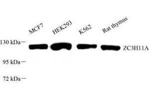 Western blot analysis of ZC3H11A (ABIN7076255) at dilution of 1: 1000