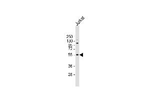 Anti-NETO2 Antibody (N-term ) at 1:2000 dilution + Jurkat whole cell lysate Lysates/proteins at 20 μg per lane. (NETO2 anticorps  (N-Term))
