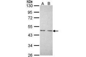 Image no. 1 for anti-Nuclear Receptor Subfamily 2, Group C, Member 1 (NR2C1) (AA 1-220) antibody (ABIN467508) (NR2C1 anticorps  (AA 1-220))