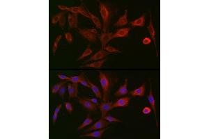 Immunofluorescence analysis of NIH/3T3 cells using PIGR Rabbit pAb (ABIN6128562, ABIN6145618, ABIN6145620 and ABIN6221728) at dilution of 1:150 (40x lens).
