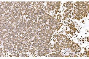 IHC analysis of SND1 using anti-SND1 antibody (ABIN7600525). (SND1 anticorps  (AA 20-204))