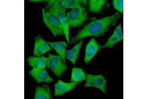 Immunofluorescenitrocellulosee of human HeLa cells stained with Hoechst 33342 (Blue) and monoclonal anti-Hexokinase antibody (1:1000) with Alexa 488 (Green). (Hexokinase anticorps  (AA 1-917))