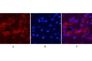 Immunofluorescence analysis of mouse brain tissue. (Ubiquitin anticorps)