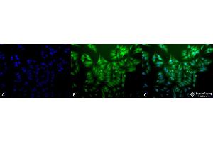 Immunocytochemistry/Immunofluorescence analysis using Mouse Anti-Ubiquitin Monoclonal Antibody, Clone 5B9-B3 .