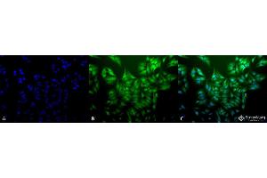 Immunocytochemistry/Immunofluorescence analysis using Mouse Anti-Ubiquitin Monoclonal Antibody, Clone 5B9-B3 . (Ubiquitin anticorps  (Biotin))