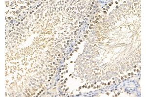 ABIN7094438 and ABIN7098486 at 1/100 staining Rat testis tissue by IHC-P.