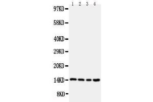 Anti-Stefin B antibody, Western blotting Lane 1: A549 Cell Lysate Lane 2: A431 Cell Lysate Lane 3: COLO320 Cell Lysate Lane 4: HELA Cell Lysate (CSTB anticorps  (Middle Region))