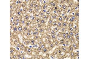 Immunohistochemistry of paraffin-embedded Rat liver using UBE2J2 Polyclonal Antibody at dilution of 1:100 (40x lens).