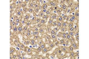 Immunohistochemistry of paraffin-embedded Rat liver using UBE2J2 Polyclonal Antibody at dilution of 1:100 (40x lens). (UBE2J2 anticorps)