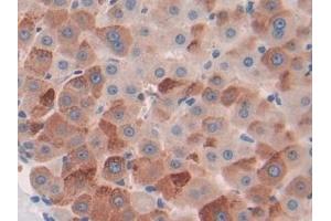 Detection of CILP in Human Liver Tissue using Polyclonal Antibody to Cartilage Intermediate Layer Protein (CILP)