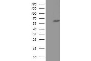 Western Blotting (WB) image for anti-Kelch-Like 2, Mayven (KLHL2) (AA 1-100), (AA 494-593) antibody (ABIN1490550) (KLHL2 anticorps  (AA 1-100, AA 494-593))
