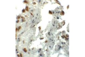 Immunohistochemistry (IHC) image for anti-Enhancer of Zeste Homolog 1 (EZH1) (N-Term) antibody (ABIN1031377) (EZH1 anticorps  (N-Term))