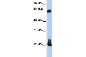 WB Suggested Anti-RHOD Antibody Titration:  0. (RHOD anticorps  (C-Term))