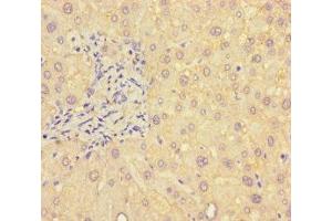 Immunohistochemistry of paraffin-embedded human liver tissue using ABIN7145396 at dilution of 1:100