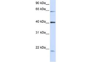 WB Suggested Anti-C19orf46 Antibody Titration:  0. (C19orf46 anticorps  (N-Term))