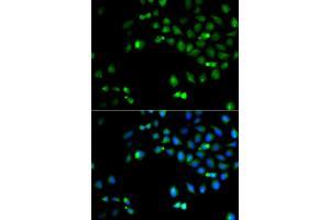 Immunofluorescence analysis of A549 cell using HOXA1 antibody. (HOXA1 anticorps)