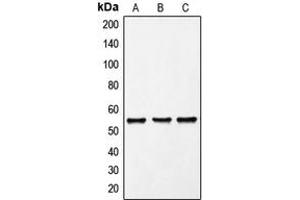 Western blot analysis of FRK expression in K562 (A), Molt4 (B), PC12 (C) whole cell lysates. (FRK anticorps  (Center))