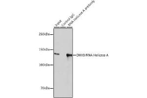 Immunoprecipitation analysis of 300 μg extracts of HeLa cells using 3 μg DHX9/DHX9/RNA Helicase A antibody (ABIN7265747).