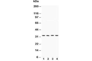 Western blot testing of Caspase-7 antibody and Lane 1:  HeLa;  2: MCF-7;  3: rat liver;  4: rat kidney (Caspase 7 anticorps  (AA 237-255))