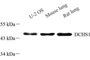 Western blot analysis of DCHS1 (ABIN7073689),at dilution of 1: 800 (DCHS1 anticorps)