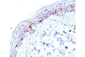 IHC testing of human human skin stained with CD1a antibody (O10). (CD1a anticorps)