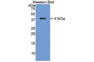 Western Blotting (WB) image for anti-Tryptase alpha/beta 1 (TPSAB1) (AA 161-262) antibody (ABIN1174171) (TPSAB1 anticorps  (AA 161-262))
