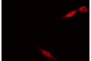 ABIN6274214 staining HeLa cells by IF/ICC. (MARK3 anticorps  (N-Term))