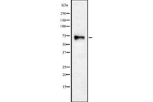 Western blot analysis of CHRNA4 using HuvEc whole cell lysates (CHRNA4 anticorps  (N-Term))