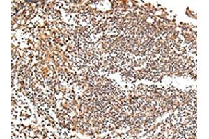 The image on the left is immunohistochemistry of paraffin-embedded Human tonsil tissue using ABIN7193077(XKR7 Antibody) at dilution 1/20, on the right is treated with synthetic peptide. (XKR7 anticorps)