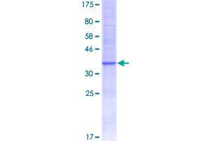 Image no. 1 for Chemokine (C-C Motif) Ligand 4-Like 1 (CCL4L1) (AA 1-92) protein (GST tag) (ABIN1348416)