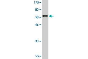Western Blot detection against Immunogen (59. (CDK4 anticorps  (AA 1-303))
