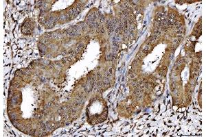 IHC analysis of AHA1/AHSA1 using anti-AHA1/AHSA1 antibody (ABIN7600708). (AHSA1 anticorps  (AA 221-264))