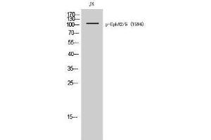 Western Blotting (WB) image for anti-EPHA2/5 (pTyr594) antibody (ABIN3180443) (EPHA2/5 (pTyr594) anticorps)