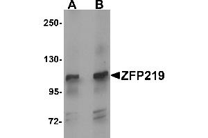 Western blot analysis of ZFP219 in mouse brain tissue lysate with ZFP219 antibody at (A) 1 and (B) 2 µg/mL. (ZNF219 anticorps  (N-Term))