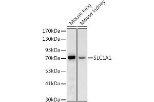 Western blot analysis of extracts of various cell lines, using (ABIN6131630, ABIN6147868, ABIN6147869 and ABIN6219899) at 1:1000 dilution. (SLC1A1 anticorps  (AA 430-524))
