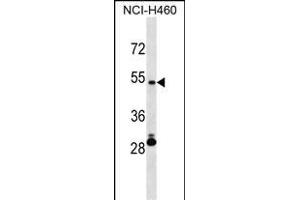 IRX6 Antibody (Center) (ABIN1538203 and ABIN2850242) western blot analysis in NCI- cell line lysates (35 μg/lane). (IRX6 anticorps  (AA 260-288))