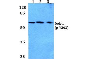 Western blot (WB) analysis of p-Dok-1 antibody at 1/500 dilution (DOK1 anticorps  (pTyr362))