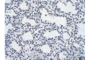 Rabbit Anti-HHEX Antibody Catalog Number: ARP31443  Paraffin Embedded Tissue: Human alveolar cell  Cellular Data: Epithelial cells of renal tubule Antibody Concentration:  4.