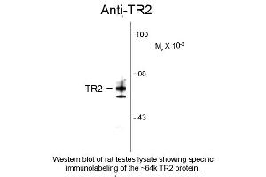 Western blot of Anti-Testicular Receptor 2 (TR2) (Rabbit) Antibody - 100-401-E45 Western Blot of Rabbit Anti-Testicular Receptor 2 (TR2) Antibody. (NR2C1 anticorps  (N-Term))
