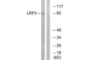 Western blot analysis of extracts from RAW264. (LRP3 anticorps)
