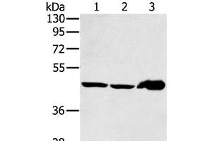 Western Blot analysis of Mouse liver tissue and PC3 cell, Human fetal liver tissue using SEC14L2 Polyclonal Antibody at dilution of 1:400 (SEC14L2 anticorps)