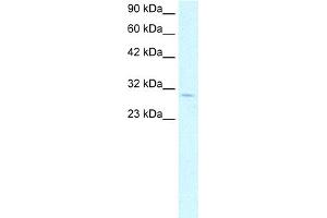 WB Suggested Anti-CDK4 Antibody Titration: 1. (CDK4 anticorps  (C-Term))