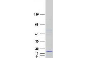 Validation with Western Blot