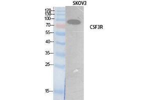 Western Blotting (WB) image for anti-Colony Stimulating Factor 3 Receptor (Granulocyte) (CSF3R) (Internal Region) antibody (ABIN3181067)