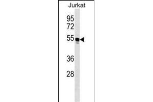 WARS Antibody (C-term) (ABIN1536896 and ABIN2849624) western blot analysis in Jurkat cell line lysates (35 μg/lane). (WARS anticorps  (C-Term))
