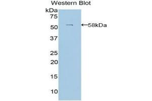 Detection of Recombinant LAMb3, Human using Polyclonal Antibody to Laminin Beta 3 (LAMb3)