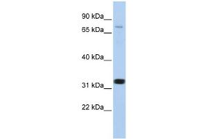 WB Suggested Anti-CACNB2 Antibody Titration:  0. (CACNB2 anticorps  (N-Term))