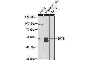 Western blot analysis of extracts of various cell lines, using EPOR antibody (ABIN3016975, ABIN3016976, ABIN1679740, ABIN1679741 and ABIN6219913) at 1:1000 dilution.