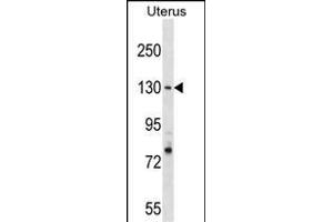 RFC1 Antibody (N-term) (ABIN1539238 and ABIN2838143) western blot analysis in Uterus tissue lysates (35 μg/lane). (RFC1 anticorps  (N-Term))