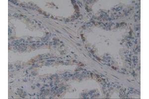 IHC-P analysis of Human Prostate Gland Tissue, with DAB staining. (Angiotensin I Converting Enzyme 1 anticorps  (AA 1160-1306))